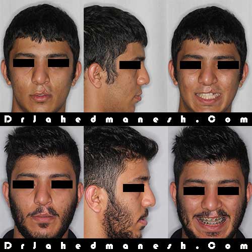 درمان ارتودنسی