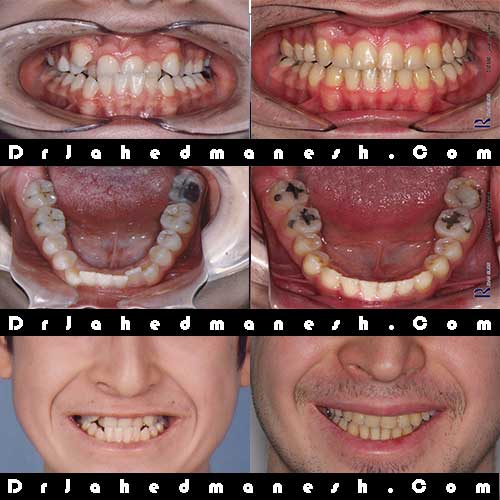 انجام درمان ارتودنسی