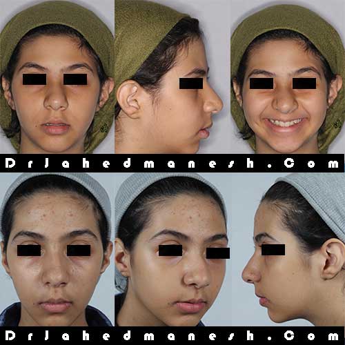 اولین معاینه ارتودنسی